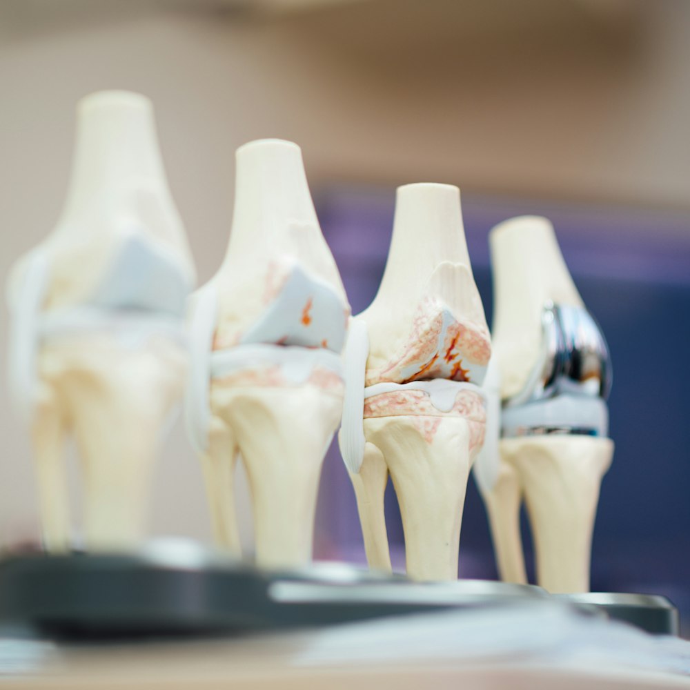 Knee Replacement Implant System