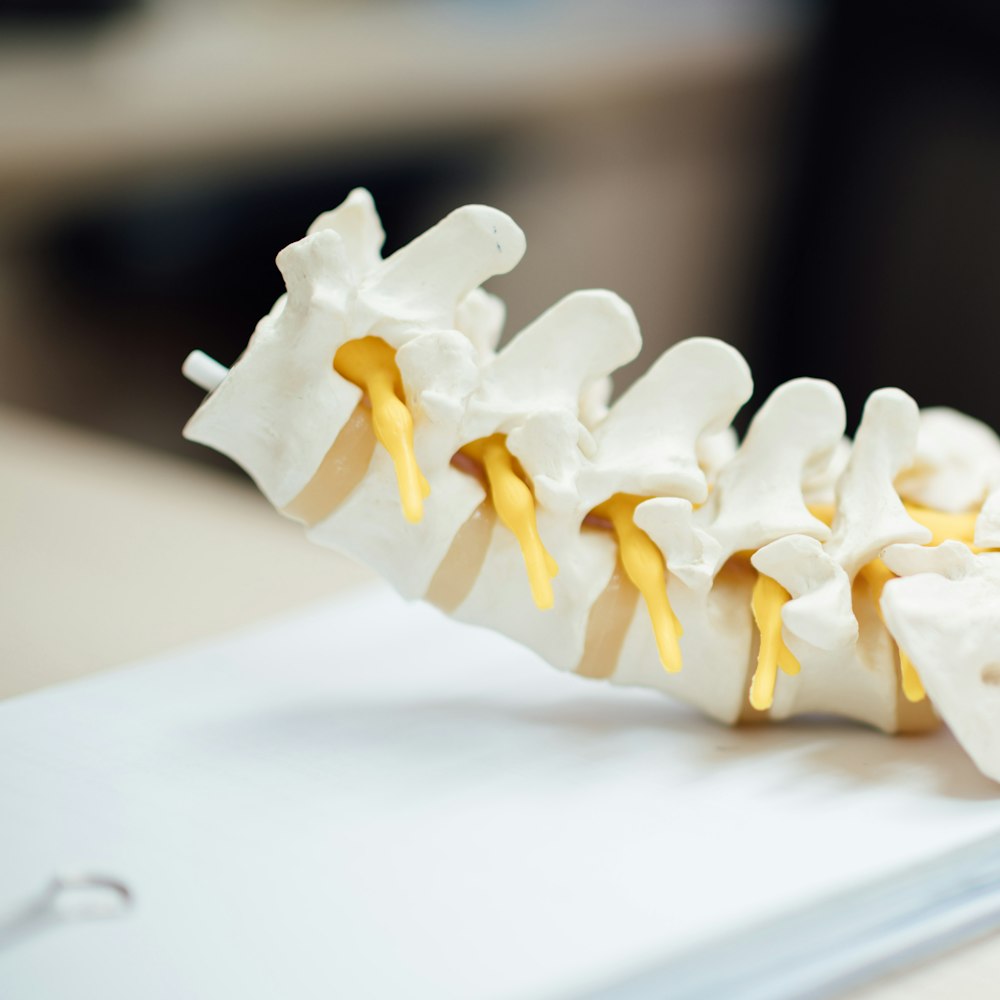 Spinal Fixation System